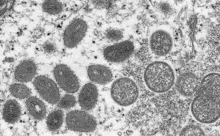 全球疫情最新情况数据分析，趋势、挑战与应对策略