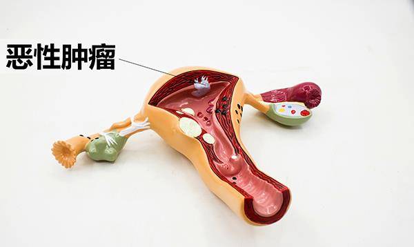 澳门,疫情重灾区的迷思与真相 澳门,疫情重灾区的迷思与真相