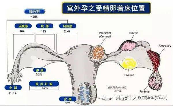 天津疫情通报的官话迷宫，当专业术语成为公众理解的隔离墙